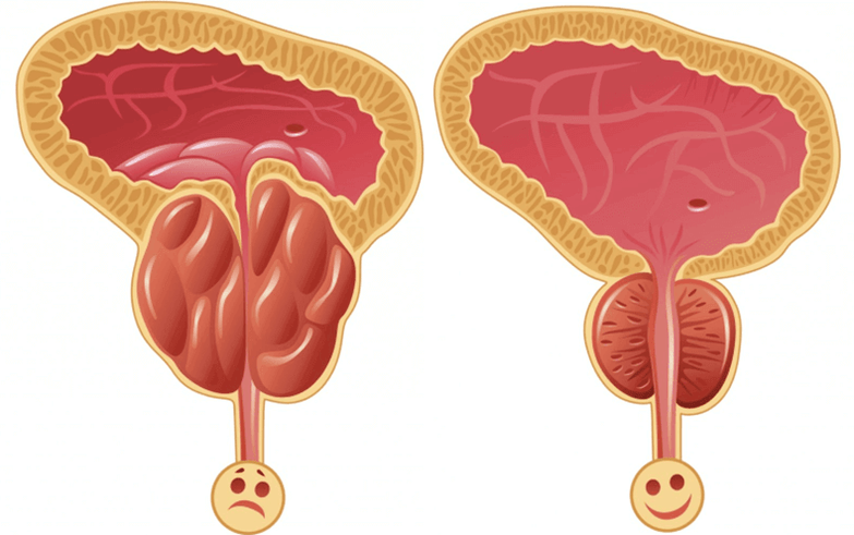 cause dei problemi di potenza negli uomini